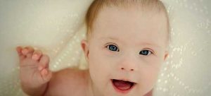 Anne Karnında Down Sendromu Teşhisi