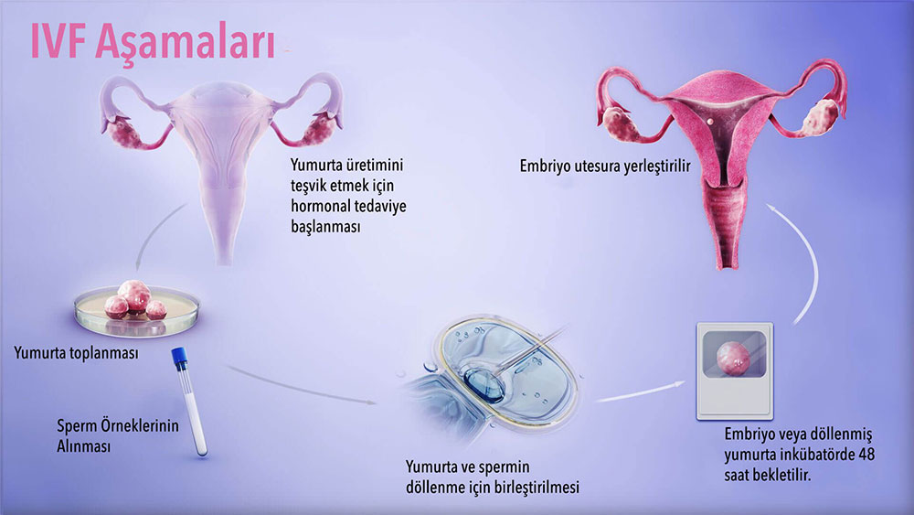 hipertansiyon ile IVF yapmak mümkün mü